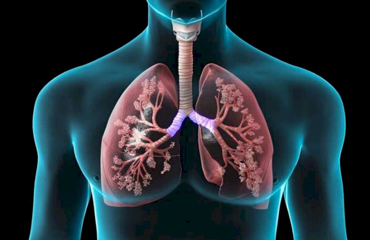 Trabalho de Biologia sobre Doenças Respiratórias